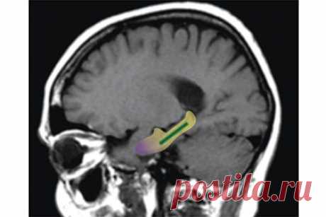 Lenta.ru: Наука и техника: Наука: Какао оказалось мощным средством против старческого слабоумия