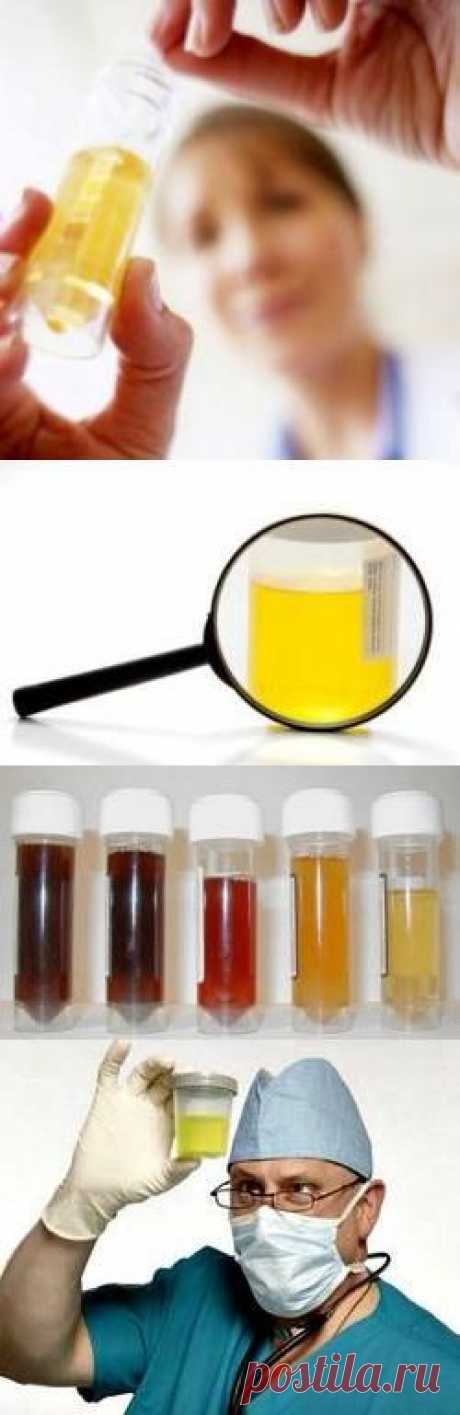 Расшифровка общего анализа мочи