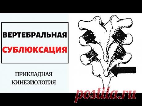 ВЕРТЕБРАЛЬНАЯ СУБЛЮКСАЦИЯ. ФРАГМЕНТ ВЕБИНАРА. ПРИКЛАДНАЯ КИНЕЗИОЛОГИЯ.