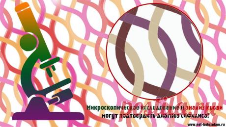 Что такое сифилис: симптомы, причины и лечение данной болезни
Для диагностики сифилиса хватает микроскопического обследования для обнаружения бледной трепонемы. Анализ крови, также, может подтвердить данный диагноз.