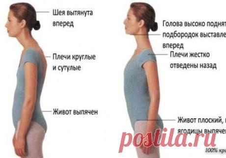 Если у вас сутулая спина, необходимо выполнять такие упражнения