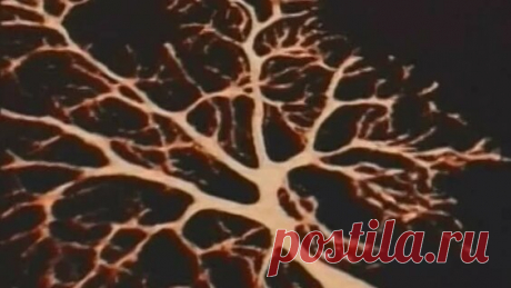 Важный фильм Галины Царёвой "Под прицелом мозг". - Яндекс.Видео