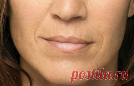 Самая "работящая" мышца на лице виновата в образовании носогубных складок | Роза Красная | Яндекс Дзен