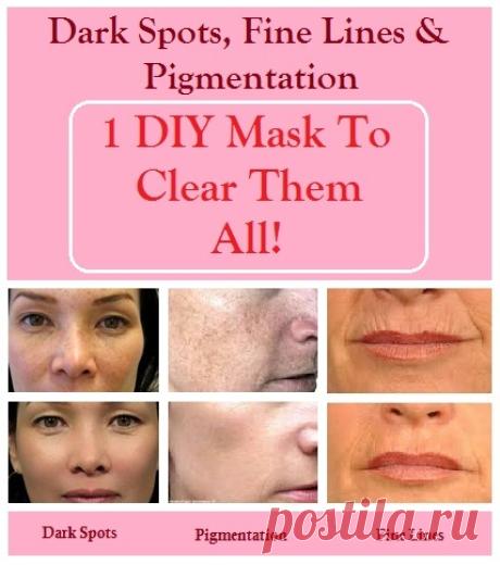 Dark Spots, Fine Lines and Pigmentation - 1 DIY Mask to Clear Them All