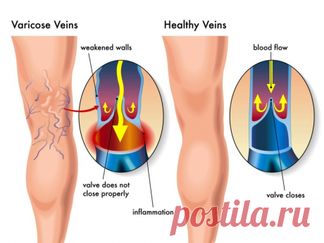 Упражнение для улучшения движения венозной крови Упражнение улучшает кровоток в органах и мышцах брюшной полости, ступнях ног, коленных и голеностопных суставах, позвоночнике — плечевом и поясничном поясах.