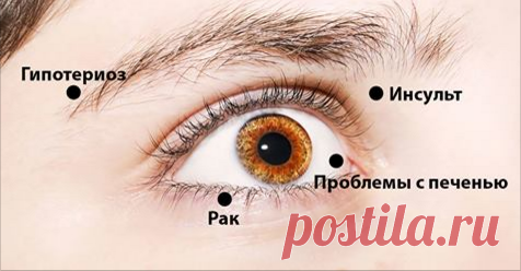 8 сигналов, при помощи которых глаза предупреждают о проблемах со здоровьем! Обрати внимание! Теперь знаю, что на самом деле нужно лечить!