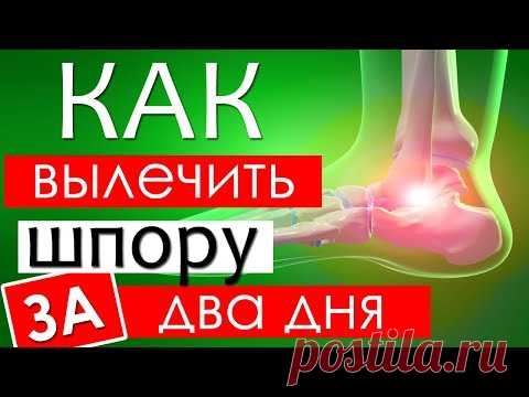 Лечение пяточной шпоры в домашних условиях народными средствами