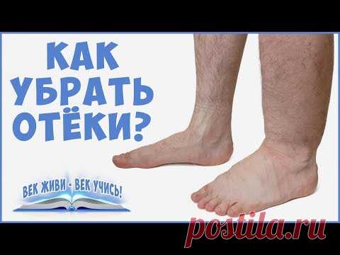 ОТЁКИ. Причины отёков. Как убрать отёки. Задержка Воды. Фролов Ю. А . Часть 1.