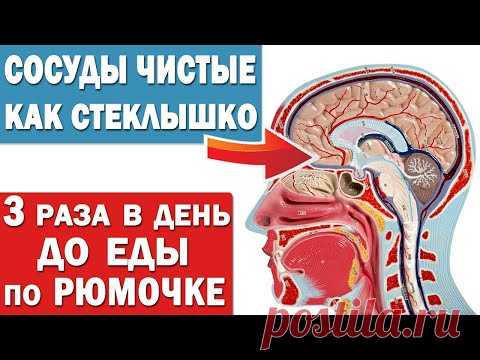 Чистка сосудов от холестерина и от тромбов в домашних условиях народными средствами без лекарств