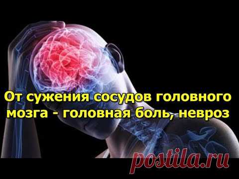 От сужения сосудов головного мозга - Народная медицина