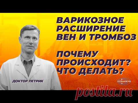 Варикозное расширение вен и тромбоз.  Почему происходит?  Что делать?