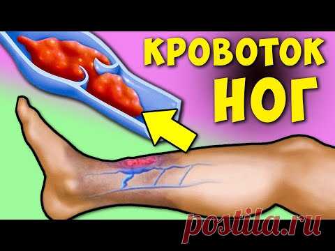 Вот как активизировать Кровообращение в Ногах! + Неочевидные симптомы Забитых Сосудов