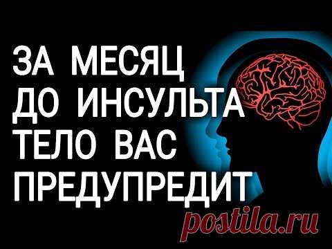 Перед инсультом ваше тело предупредит вас