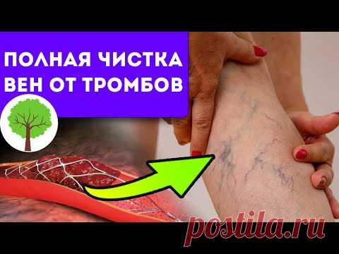 Вкусняшек больше, а тромбов — меньше! Диета для чистой и жидкой крови