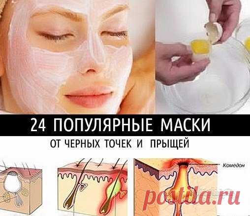 24 ПОПУЛЯРНЫЕ МАСКИ ОТ ЧЕРНЫХ ТОЧЕК И ПРЫЩЕЙ!