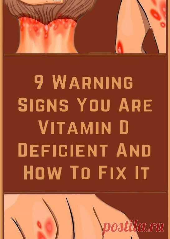 8 Signs That You May Have Deficiency In Vitamin D And How To Get More