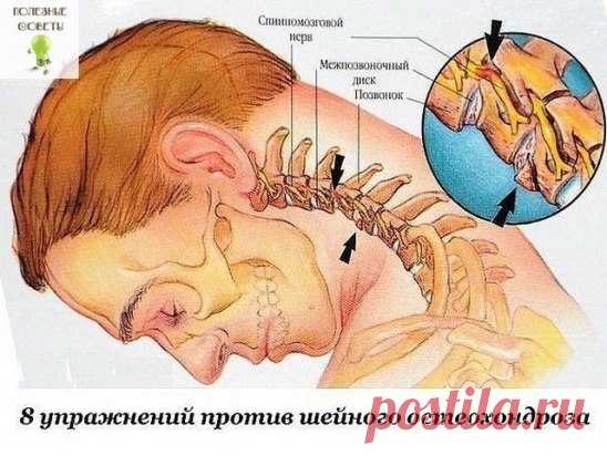 (28) Одноклассники