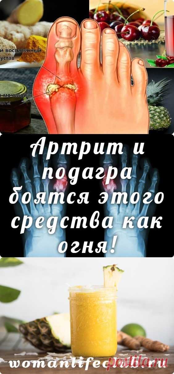 Артрит и подагра боятся этого средства как огня! - womanlifeclub.ru