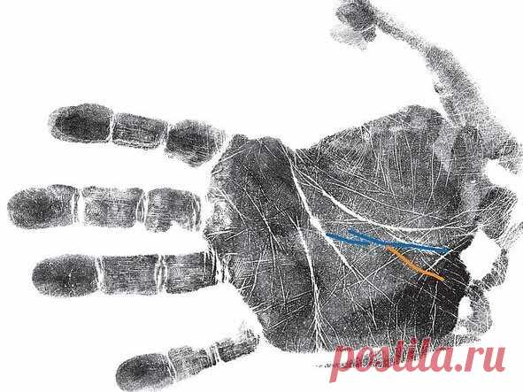 Как узнать о болезнях по руке: секреты хиромантии | Красота внутри вас | Яндекс Дзен