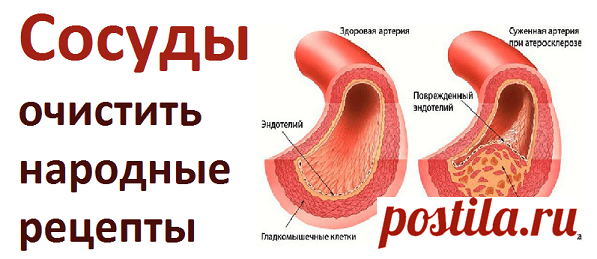 Как очистить сосуды по народным рецептам | Советы целительницы