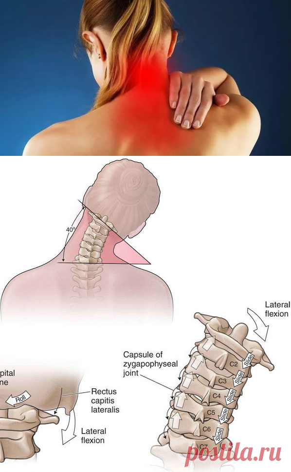 Боль в шее сзади: причины, методы лечения в домашних условиях