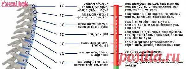 Профилактика остеохондроза шейного отдела позвоночника.