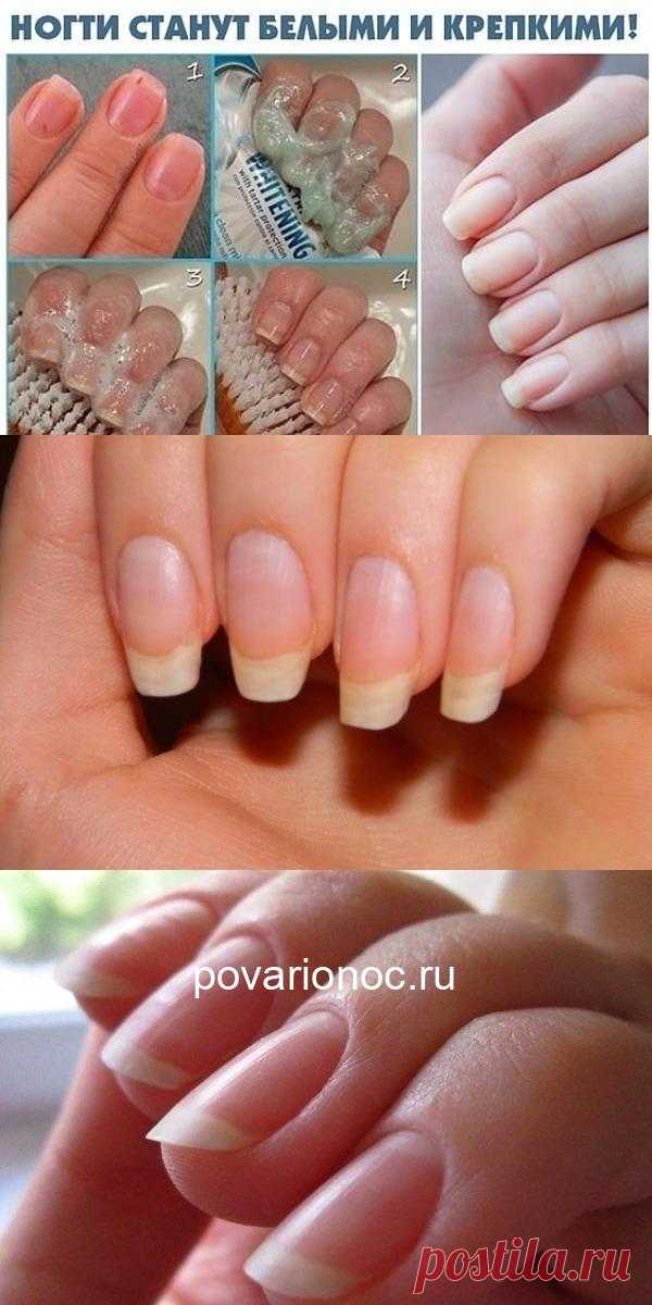 Что делать чтобы ногти быстро. Крепкие ногти. Чтобы ногти были крепкими. Как выглядят Здоровые и крепкие ногти.