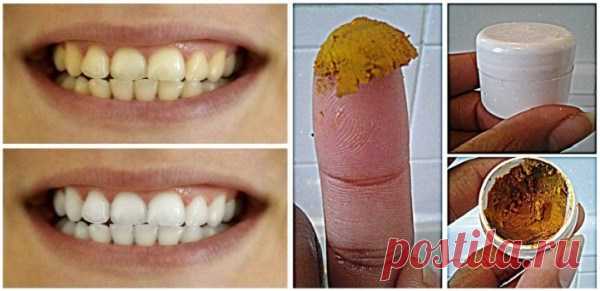 Будьте сами стоматологом! Вылечите кариес, десна и отбелите зубы с этой НАТУРАЛЬНОЙ зубной пастой!