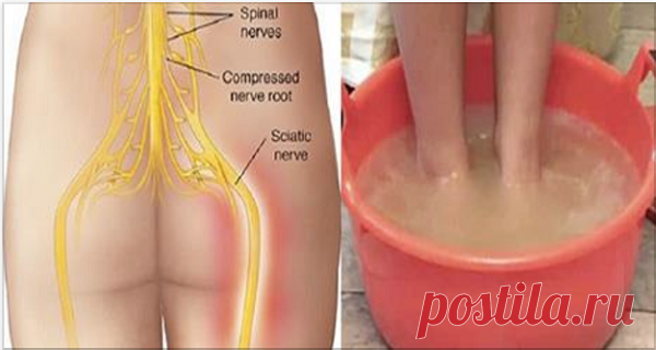 Попрощайтесь с седалищными невралгиями всего за 10 минут благодаря этому естественному способу! | Naget.Ru