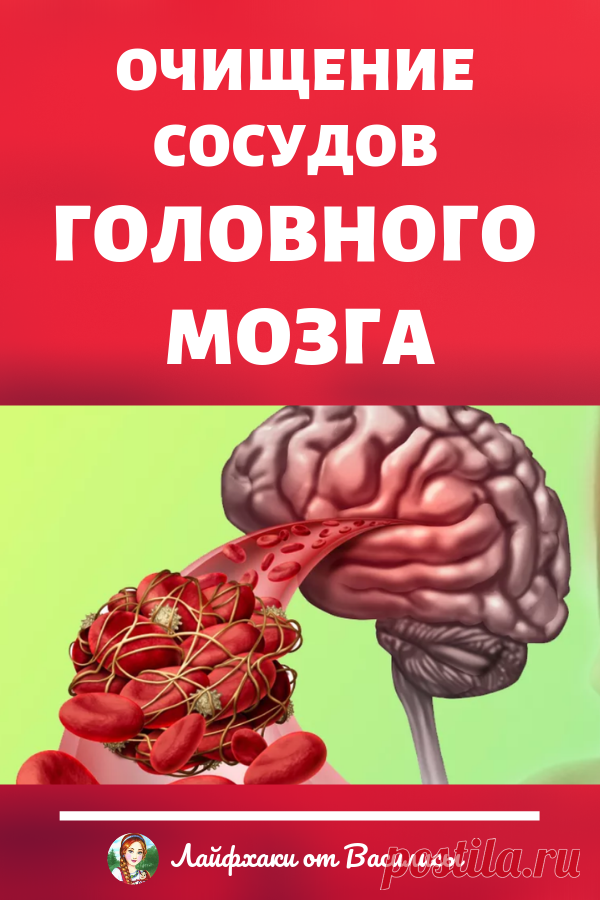 Очищение сосудов головного мозга – улучшение памяти и профилактика инсульта. Здоровье в домашних условиях