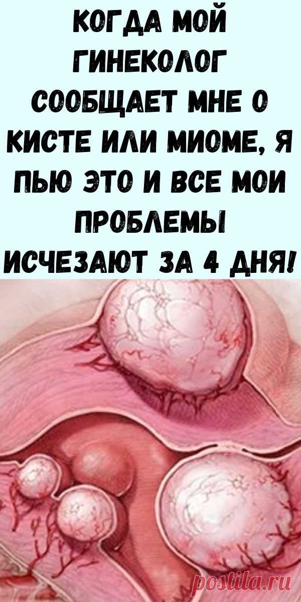 Когда мой гинеколог сообщает мне о кисте или миоме, я пью это и все мои проблемы исчезают за 4 дня! - Журнал для женщин