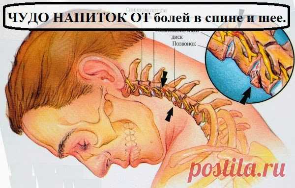 Ваш личный врач.: ЧУДО НАПИТОК ОТ болей в спине и шее.