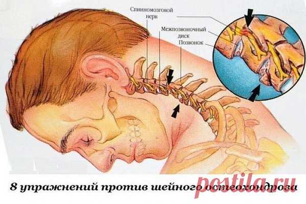 Восемь упражнений против шейного остеохондроза Первые проявления шейного остеохондроза — боли в спине, головные боли, головокружение, «мушки» в глазах, ухудшение слуха или шумы, а также покачивание при ходьбе в результате нарушения координации. Чтобы этого не случилось, предлагаем нехитрые упражнения, которые помогут вам победить остеохондроз и сберечь здоровье. 1. Подбородок опустите к шее. Поверните голову сначала 5 раз вправо, а затем …