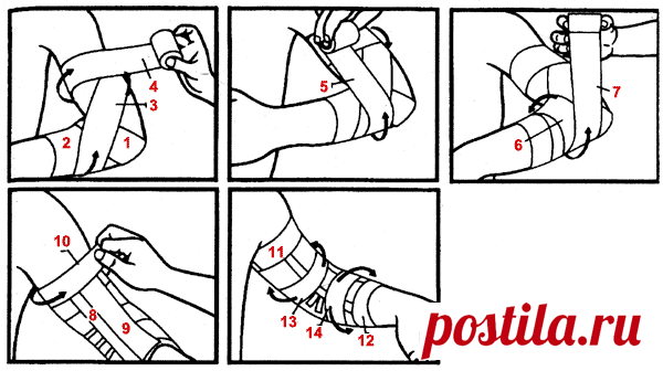 Что такое тейпирование, как правильно делать тейпирование - sportobzor.ru