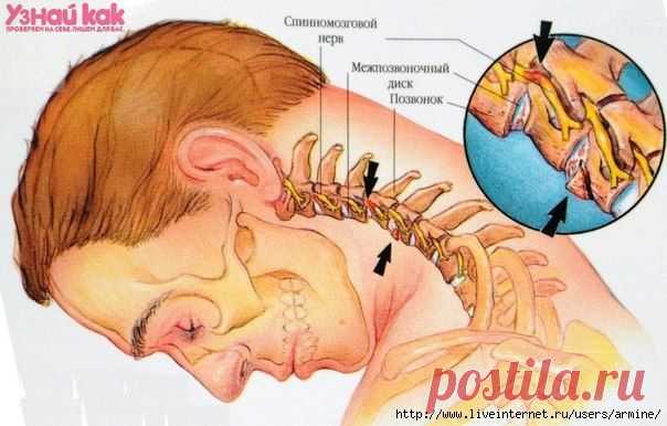 Если у вас болит шея..