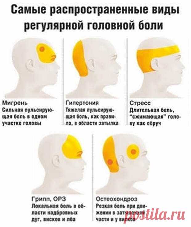 Давление или мигрень? 7 причин головной боли и что делать - Хитрости Жизни - медиаплатформа МирТесен Говорят, голова болит у всех, но у всех она болит по-разному. А можно ли самостоятельно определить, какой вид головной боли мешает жить? Отвечает профессор кафедры госпитальной терапии РНИМУ им. Пирогова Александр Карабиненко, aif.ru: - Сильнее и чаще всего голова болит у людей с 25 до 45 лет - в