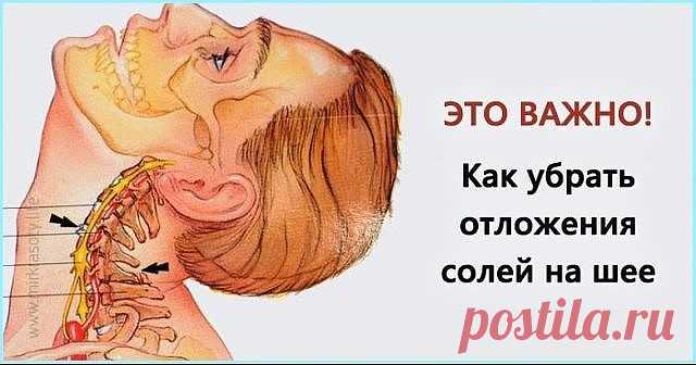 КАК УБРАТЬ ОТЛОЖЕНИЯ СОЛЕЙ НА ШЕЕ

Отложение солей на шее называют остеохондрозом шейного отдела позвоночника. Вследствие того, что шейный отдел позвоночника является весьма важной частью организма, нарушения в этой области приводят к серьезным нарушениям всего организма.

Область шеи является местом сосредоточения сосудов и нервов, питающих ткани шеи, лица, черепа. Кроме того, вследствие защемления нервных окончаний начинаются головные боли, онемение конечностей, слабость...