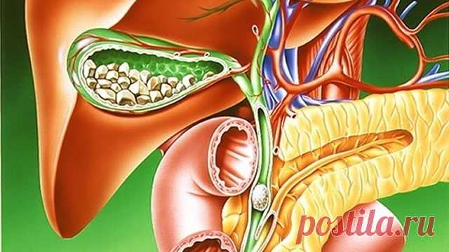 Камни в желчном...??? Растворяем...