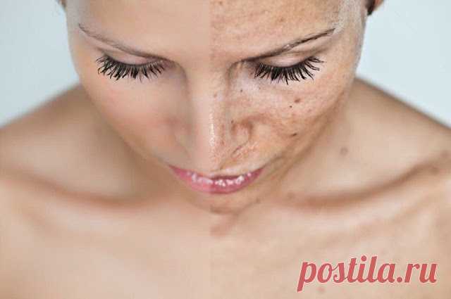 Применение масел для избавления от пигментных пятен на лице 


Пигментные пятна на коже могут появляться по разным причинам. Одна из самых распространённых – воздействие ультрафиолетовых лучей и несоблюдение правил при загаре.


Как правило, пигментные пятна н…