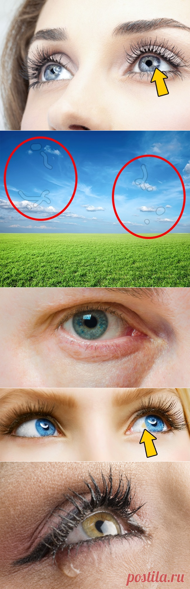 Что глаза могут рассказать о вашем здоровье | Болтай