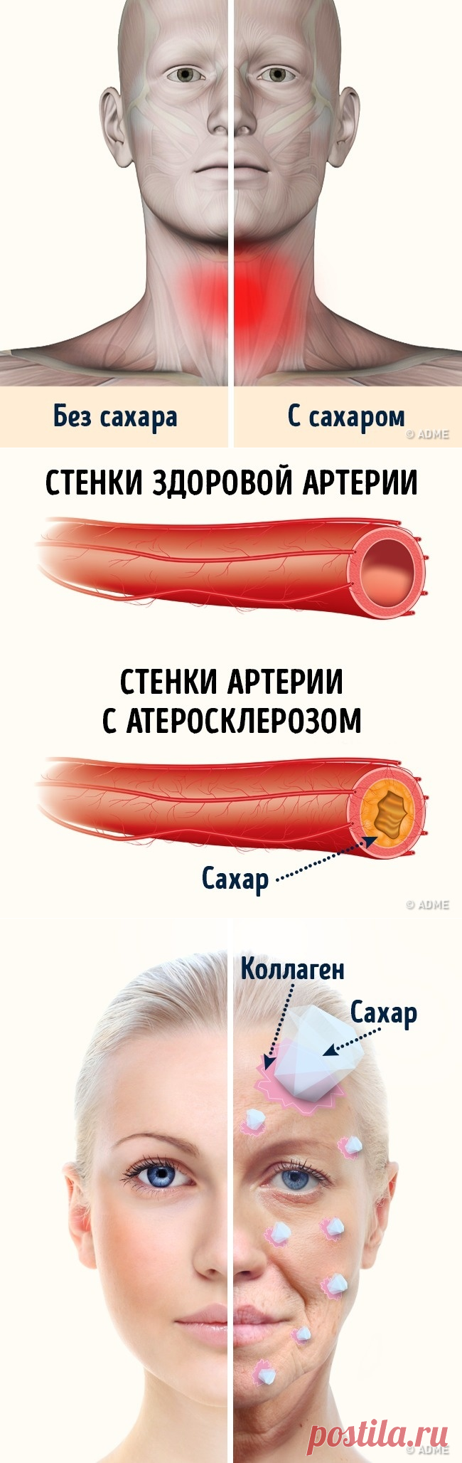 4 опасных свойства сахара, о которых мы не подозревали