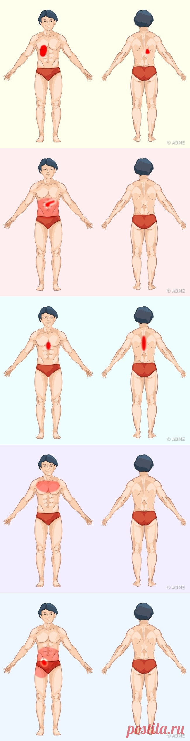 9 способов определить причину боли по месту ее локализации