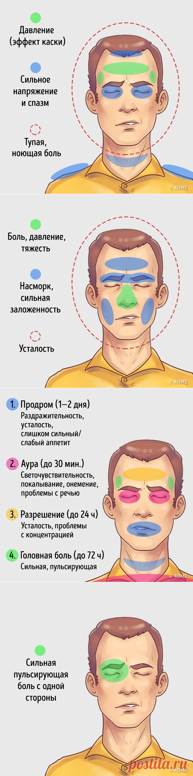 5 типов головной боли и способы быстро от них избавиться