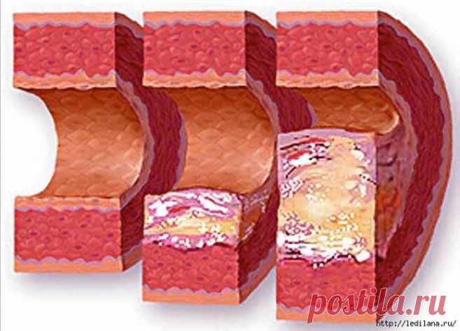 РЕЦЕПТЫ ТИБЕТА. КАК СНИЗИТЬ УРОВЕНЬ ХОЛЕСТЕРИНА В КРОВИ.. | Познавательный сайт ,,1000 мелочей"