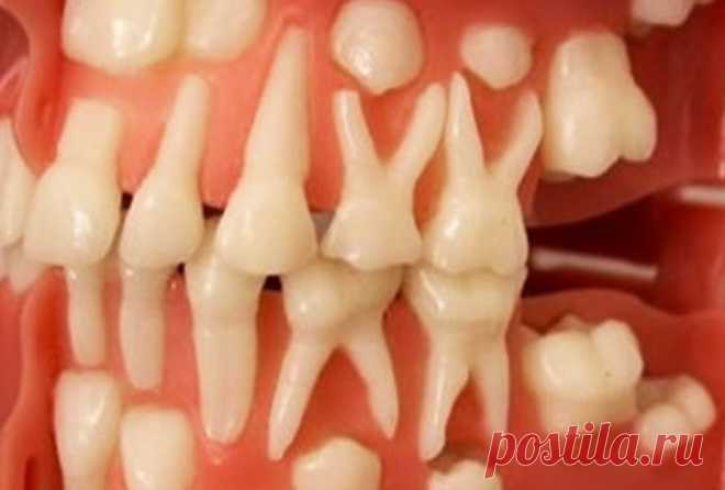 Стало возможным вырастить зубы в любом возрасте Теперь вы можете вырастить зубы самостоятельно Невероятное открытие профессора стоматологии из Колумбийского университета США потрясла научный мир! Оказывается, что зубы можно вырастить в любом возрасте...