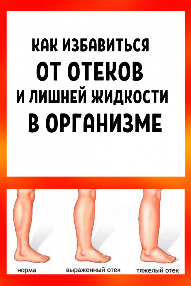 От отечности организма. Избавляемся от отеков и лишней жидкости в организме. Лишняя жидкость в теле.