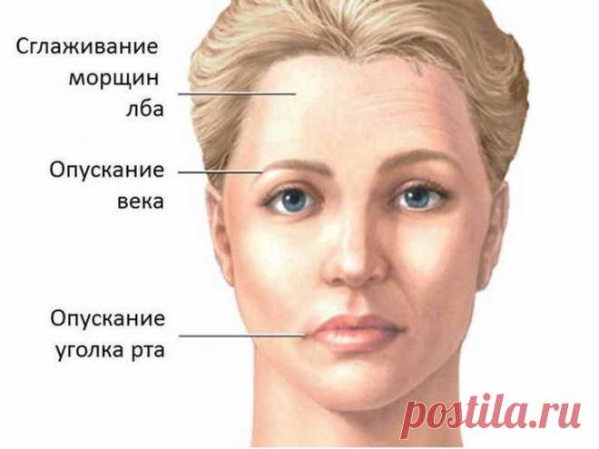 Упражнения для коррекции асимметрии лица