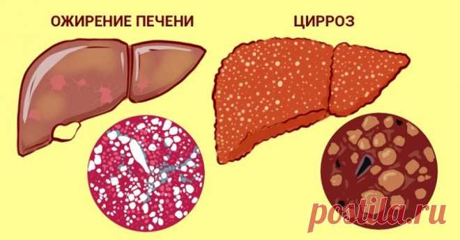 5 народных рецептов из трав для печени