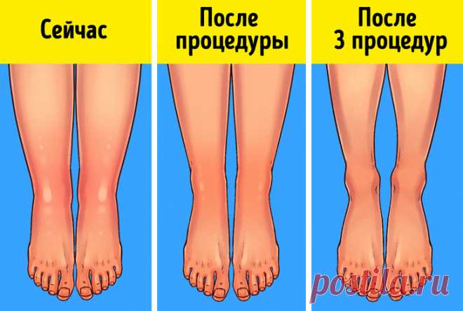 10+ способов использования обычной соды, о которых мало кто знает