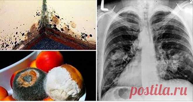 Болезнь плесени — что это такое и 14 признаков, что она у вас есть!